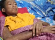 Penderita Autoimun Asal Purbalingga Butuh Uluran Tangan