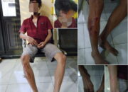 Pemuda Pohjentrek Babak Belur “Dikeroyok” Tetangga Lantaran Dituduh Mencuri Celana Dalam, Berujung Lapor Polisi