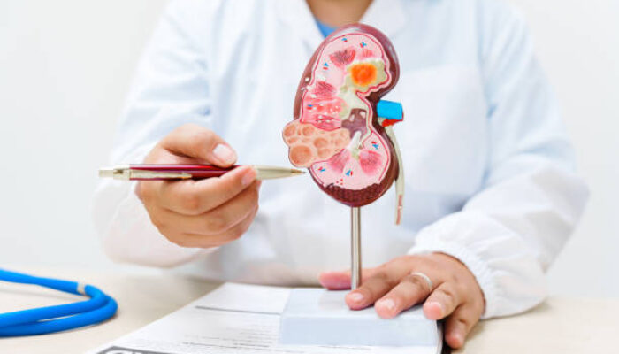 Kenali 3 Ciri Urine yang Menunjukkan Ginjal Anda Bermasalah